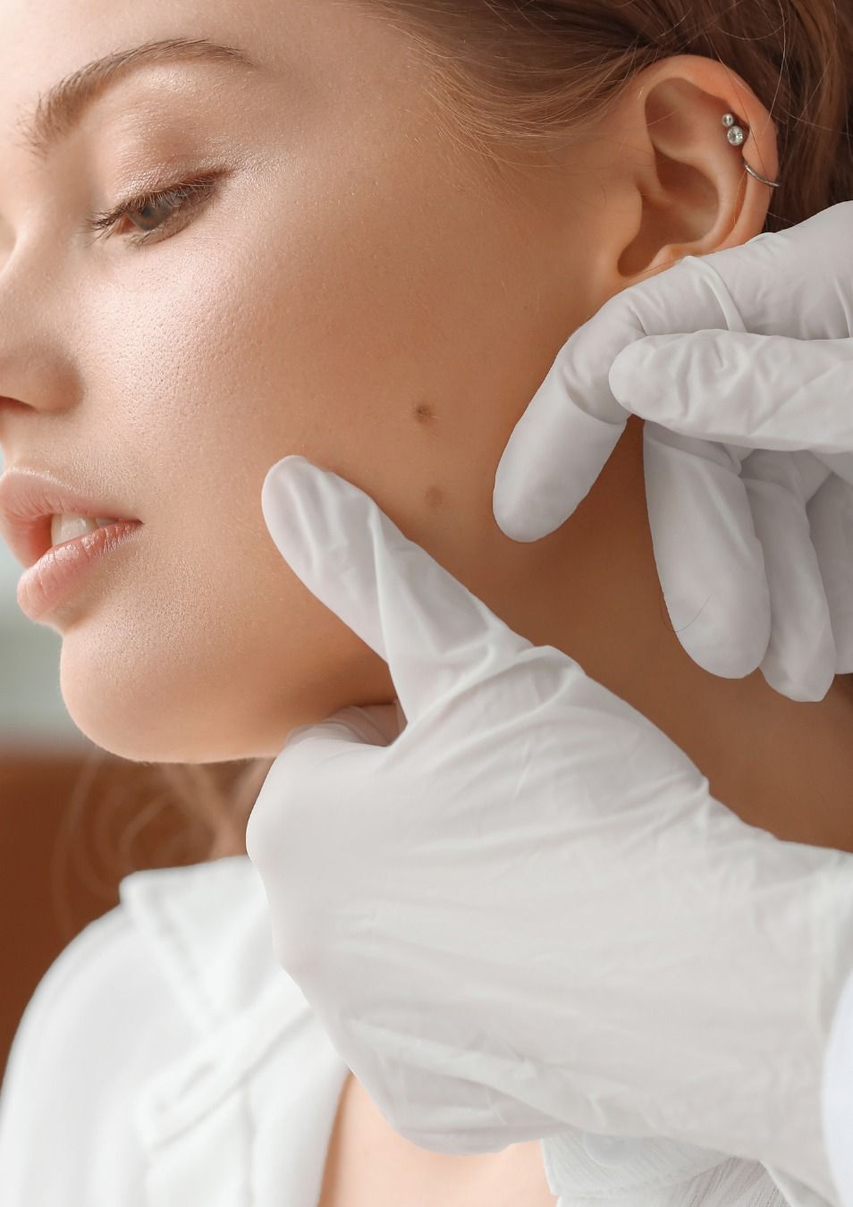 Management of benign or suspicious skin lesions